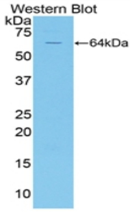 CD95 / FAS Antibody - Western blot of CD95 / FAS antibody.