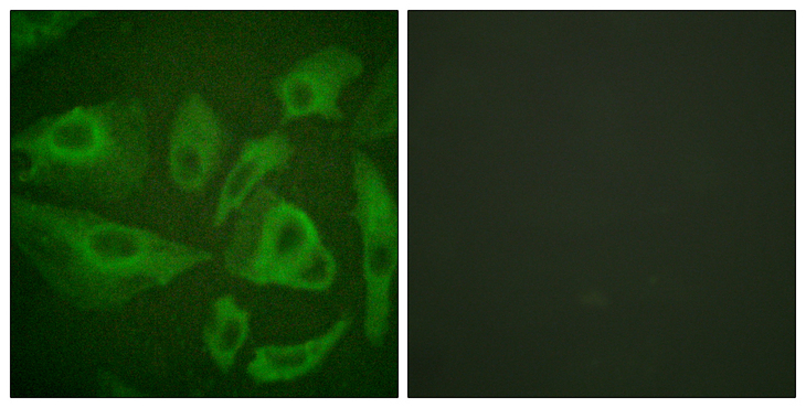 CD95 / FAS Antibody - Immunofluorescence analysis of HeLa cells, using FAS Antibody. The picture on the right is blocked with the synthesized peptide.