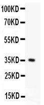 CD95 / FAS Antibody - FAS antibody Western blot. All lanes: Anti FAS at 0.5 ug/ml. WB: Recombinant Human FAS Protein 0.5ng. Predicted band size: 35 kD. Observed band size: 35 kD.