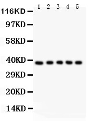CD95 / FAS Antibody - FAS antibody Western blot. All lanes: Anti FAS at 0.5 ug/ml. Lane 1: HELA Whole Cell Lysate at 40 ug. Lane 2: JURKAT Whole Cell Lysate at 40 ug. Lane 3: A549 Whole Cell Lysate at 40 ug. Lane 4: SMMC Whole Cell Lysate at 40 ug. Lane 5: K562 Whole Cell Lysate at 40 ug. Predicted band size: 37 kD. Observed band size: 37 kD.