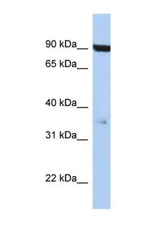 CD95 / FAS Antibody - FAS / CD95 antibody Western blot of Jurkat Cell lysate. Antibody concentration 1 ug/ml. This image was taken for the unconjugated form of this product. Other forms have not been tested.
