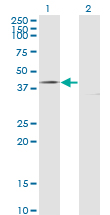 CD95 / FAS Antibody - Western Blot analysis of FAS expression in transfected 293T cell line by FAS monoclonal antibody (M01), clone 5B4.Lane 1: FAS transfected lysate(37.7 KDa).Lane 2: Non-transfected lysate.