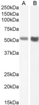 CD95 / FAS Antibody - Flow-cytometry on Jurkat cells.