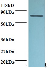 CD95 / FAS Antibody - Western blot of Tumor necrosis factor receptor superfamily member 6 antibody at 2 ug/ml + 293T whole cell lysate. Secondary: Goat polyclonal to Rabbit IgG at 1:15000 dilution. Predicted band size: 36.8 kDa. Observed band size: 70 kDa.  This image was taken for the unconjugated form of this product. Other forms have not been tested.