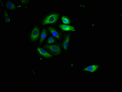CD95 / FAS Antibody - Immunofluorescence staining of A549 cells with FAS Antibody at 1:400, counter-stained with DAPI. The cells were fixed in 4% formaldehyde, permeabilized using 0.2% Triton X-100 and blocked in 10% normal Goat Serum. The cells were then incubated with the antibody overnight at 4°C. The secondary antibody was Alexa Fluor 488-congugated AffiniPure Goat Anti-Rabbit IgG(H+L).