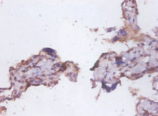 CD95 / FAS Antibody - Immunohistochemistry of paraffin-embedded human placenta tissue using FAS Antibody at dilution of 1:100