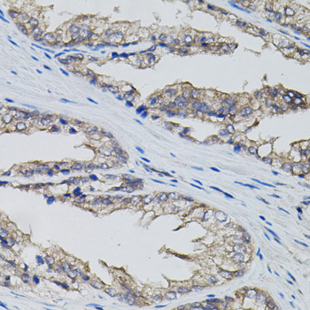CD95 / FAS Antibody - Immunohistochemistry of paraffin-embedded human prostate.