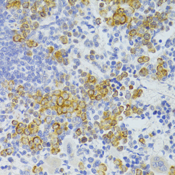 CD95 / FAS Antibody - Immunohistochemistry of paraffin-embedded rat spleen using FAS Antibodyat dilution of 1:100 (40x lens).