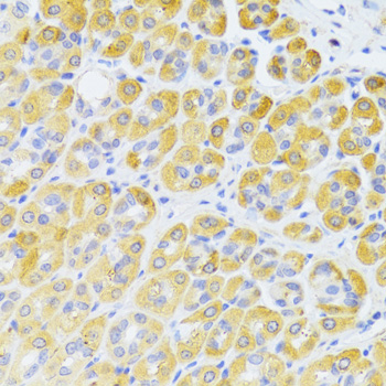 CD95 / FAS Antibody - Immunohistochemistry of paraffin-embedded rat kidney using FAS Antibodyat dilution of 1:100 (40x lens).
