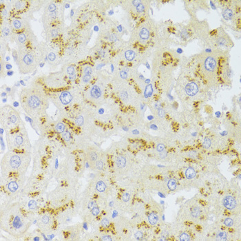 CD95 / FAS Antibody - Immunohistochemistry of paraffin-embedded human liver using FAS Antibodyat dilution of 1:100 (40x lens).