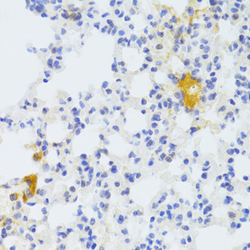CD95 / FAS Antibody - Immunohistochemistry of paraffin-embedded mouse lung using FAS Antibodyat dilution of 1:100 (40x lens).