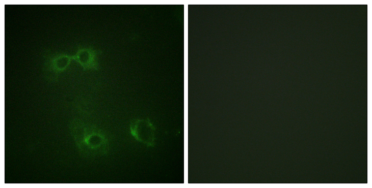 CD95 / FAS Antibody - Immunofluorescence analysis of COS7 cells, using FAS (Phospho-Tyr291) Antibody. The picture on the right is blocked with the phospho peptide.