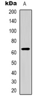 CD96 / TACTILE Antibody - Western blot analysis of CD96 expression in HEK293T (A) whole cell lysates.