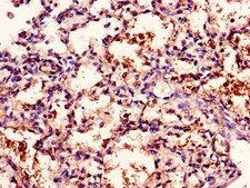 CD96 / TACTILE Antibody - Immunohistochemistry of paraffin-embedded human lung tissue using CD96 Antibody at dilution of 1:100