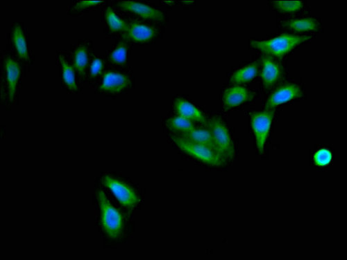 CD96 / TACTILE Antibody - Immunofluorescent analysis of HepG2 cells using CD96 Antibody at a dilution of 1:100 and Alexa Fluor 488-congugated AffiniPure Goat Anti-Rabbit IgG(H+L)