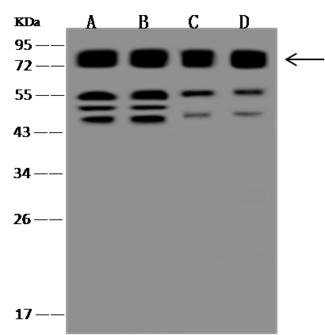 CD98 Antibody - Anti-CD98 rabbit polyclonal antibody at 1:500 dilution. Lane A: HeLa Whole Cell Lysate. Lane B: HepG2 Whole Cell Lysate. Lane C: Raji Whole Cell Lysate. Lane D: Molt-4 Whole Cell Lysate. Lysates/proteins at 30 ug per lane. Secondary: Goat Anti-Rabbit IgG (H+L)/HRP at 1/10000 dilution. Developed using the technique. Performed under reducing conditions. Predicted band size: 68 kDa. Observed band size: 75 kDa. (We are unsure as to the identity of these extra bands.)
