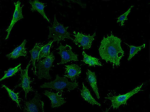 CD98 Antibody - Immunofluorescence staining of SLC3A2 in HeLa cells. Cells were fixed with 4% PFA, blocked with 10% serum, and incubated with rabbit anti-Human SLC3A2 polyclonal antibody (dilution ratio 1:1000) at 4°C overnight. Then cells were stained with the Alexa Fluor 488-conjugated Goat Anti-rabbit IgG secondary antibody (green) and counterstained with DAPI (blue). Positive staining was localized to cytoplasm and cell membrane.