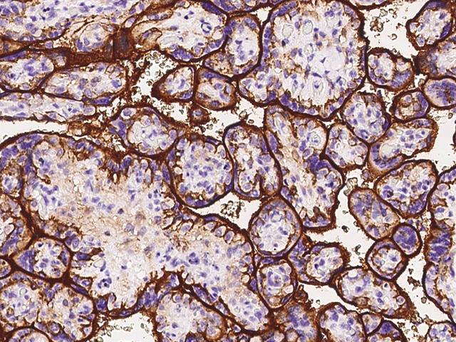 CD98 Antibody - Immunochemical staining of human SLC3A2 in human placenta with rabbit polyclonal antibody at 1:1000 dilution, formalin-fixed paraffin embedded sections.