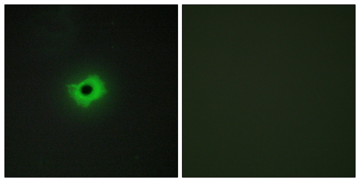 CD99 Antibody - Immunofluorescence analysis of COS7 cells, using CD99 Antibody. The picture on the right is blocked with the synthesized peptide.
