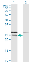 CD99 Antibody - Western Blot analysis of CD99 expression in transfected 293T cell line by CD99 monoclonal antibody (M01), clone 3A10.Lane 1: CD99 transfected lysate(18.8 KDa).Lane 2: Non-transfected lysate.