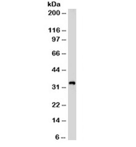 CD99 Antibody - Western blot testing of Jurkat cell lysate with CD99 antibody (clone HO36-1.1). Expected molecular weight: ~20/32kDa (unmodified/glycosylated). This image was taken for the unmodified form of this product. Other forms have not been tested.