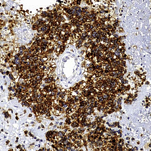 CD99 Antibody - Formalin-fixed, paraffin-embedded human tonsil stained with CD99/MIC2 antibody.