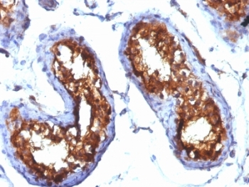 CD99 Antibody - Formalin-fixed, paraffin-embedded human testicular carcinoma stained with CD99 antibody (MIC2/877).  This image was taken for the unmodified form of this product. Other forms have not been tested.