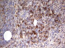 CD99 Antibody - IHC of paraffin-embedded Human lymph node tissue using anti-CD99 mouse monoclonal antibody. (Heat-induced epitope retrieval by 10mM citric buffer, pH6.0, 120°C for 3min).