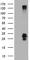 CD99 Antibody - HEK293T cells were transfected with the pCMV6-ENTRY control (Left lane) or pCMV6-ENTRY CD99 (Right lane) cDNA for 48 hrs and lysed. Equivalent amounts of cell lysates (5 ug per lane) were separated by SDS-PAGE and immunoblotted with anti-CD99.