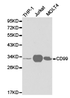 CD99 Antibody - Western blot of extracts of various cell lines, using CD99 antibody.