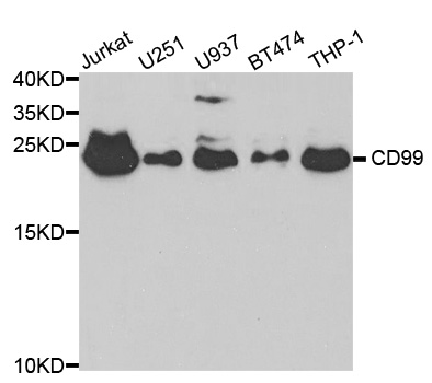 CD99 Antibody - Western blot analysis of extracts of various cell lines.