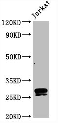 CD99 Antibody - Western Blot Positive WB detected in:Jurkat whole cell lysate All Lanes:CD99 antibody at 0.8µg/ml Secondary Goat polyclonal to rabbit IgG at 1/50000 dilution Predicted band size: 28 KDa Observed band size: 28 KDa