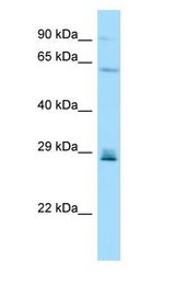 CD99L2 Antibody - CD99L2 antibody Western Blot of HeLa.  This image was taken for the unconjugated form of this product. Other forms have not been tested.