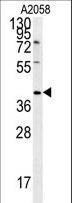 CD99L2 Antibody - CD99L2 Antibody western blot of A2058 cell line lysates (35 ug/lane). The CD99L2 antibody detected the CD99L2 protein (arrow).