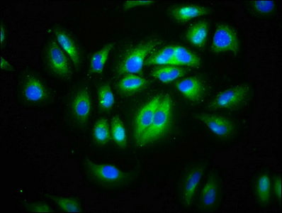 CD99L2 Antibody - Immunofluorescence staining of A549 cells at a dilution of 1:133, counter-stained with DAPI. The cells were fixed in 4% formaldehyde, permeabilized using 0.2% Triton X-100 and blocked in 10% normal Goat Serum. The cells were then incubated with the antibody overnight at 4 °C.The secondary antibody was Alexa Fluor 488-congugated AffiniPure Goat Anti-Rabbit IgG (H+L) .