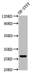 CD99L2 Antibody - Western Blot Positive WB detected in: SH-SY5Y whole cell lysate All lanes: CD99L2 antibody at 4µg/ml Secondary Goat polyclonal to rabbit IgG at 1/50000 dilution Predicted band size: 28, 23, 21, 16, 29 kDa Observed band size: 28 kDa