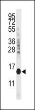 CDA / Cytidine Deaminase Antibody - Western blot of anti-CDA Antibody in mouse kidney tissue lysates (35 ug/lane). CDA (arrow) was detected using the purified antibody.