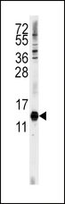 CDA / Cytidine Deaminase Antibody - Western blot of anti-CDA Antibody in HeLa cell line lysates (35 ug/lane). CDA (arrow) was detected using the purified antibody.