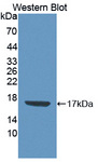 CDA / Cytidine Deaminase Antibody - Western blot of CDA / Cytidine Deaminase antibody.