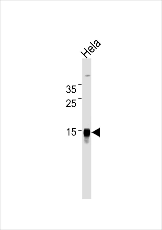 CDA / Cytidine Deaminase Antibody - CDA Antibody western blot of HeLa cell line lysates (35 ug/lane). The CDA antibody detected the CDA protein (arrow).