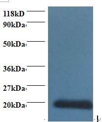CDA / Cytidine Deaminase Antibody - Western blot of Cytidine deaminase antibody at 2 ug/ml + 293T whole cell lysate. Secondary: Goat polyclonal to Rabbit IgG at 1:15000 dilution. Predicted band size: 16.5 kDa. Observed band size: 20 kDa.  This image was taken for the unconjugated form of this product. Other forms have not been tested.