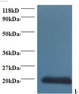 CDA / Cytidine Deaminase Antibody - Western blot of Cytidine deaminase antibody at 2 ug/ml + 293T whole cell lysate. Secondary: Goat polyclonal to Rabbit IgG at 1:15000 dilution. Predicted band size: 16.5 kDa. Observed band size: 20 kDa.  This image was taken for the unconjugated form of this product. Other forms have not been tested.