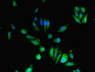 CDA / Cytidine Deaminase Antibody - Immunofluorescent analysis of Hela cells using CDA Antibody at dilution of 1:100 and Alexa Fluor 488-congugated AffiniPure Goat Anti-Rabbit IgG(H+L)