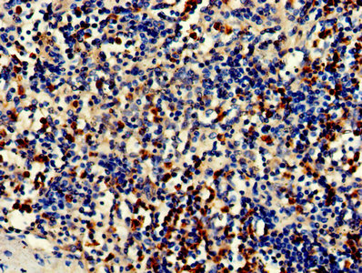 CDA / Cytidine Deaminase Antibody - Immunohistochemistry of paraffin-embedded human spleen tissue using CDA Antibody at dilution of 1:50