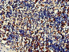 CDA / Cytidine Deaminase Antibody - Immunohistochemistry of paraffin-embedded human spleen tissue using CDA Antibody at dilution of 1:50