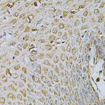 CDA / Cytidine Deaminase Antibody - Immunohistochemistry of paraffin-embedded human esophagus using CDA Antibody at dilution of 1:100 (40x lens).