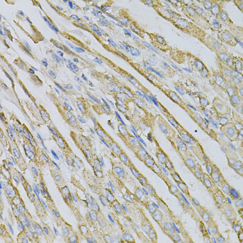 CDA / Cytidine Deaminase Antibody - Immunohistochemistry of paraffin-embedded mouse stomach using CDA Antibody at dilution of 1:100 (40x lens).
