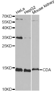 CDA / Cytidine Deaminase Antibody - Western blot analysis of extracts of various cell lines, using CDA antibody at 1:1000 dilution. The secondary antibody used was an HRP Goat Anti-Rabbit IgG (H+L) at 1:10000 dilution. Lysates were loaded 25ug per lane and 3% nonfat dry milk in TBST was used for blocking.