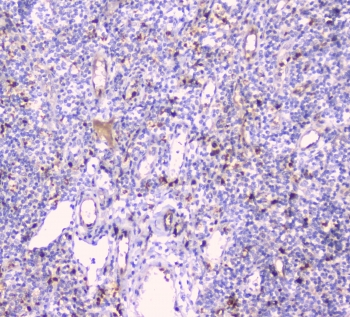 CDA / Cytidine Deaminase Antibody - IHC staining of FFPE human tonsil with CDA antibody at 1ug/ml. HIER: boil tissue sections in pH6, 10mM citrate buffer, for 10-20 min and allow to cool before testing.