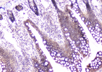 CDA / Cytidine Deaminase Antibody - IHC staining of FFPE rat intestine with CDA antibody at 1ug/ml. HIER: boil tissue sections in pH6, 10mM citrate buffer, for 10-20 min and allow to cool before testing.